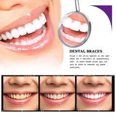V34 Tooth Cleaning Mousse – Whitening Foaming Mousse to Remove Yellow Stains & Promote Healthy Gums for a Brighter Smile