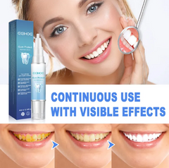 Teeth Repair Gel – Deep Gum & Enamel Restoration Formula for Swollen, Aching & Sensitive Gums