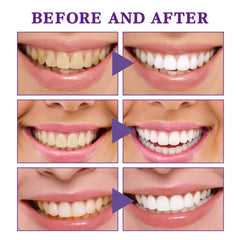 V34 Tooth Cleaning Mousse – Whitening Foaming Mousse to Remove Yellow Stains & Promote Healthy Gums for a Brighter Smile