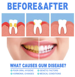 Teeth Repair Gel – Deep Gum & Enamel Restoration Formula for Swollen, Aching & Sensitive Gums